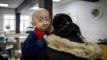 Bedeni hızla yaşlanan 9 yaşındaki Veysel, iyileşebilme umudunu katiyen kaybetmiyor