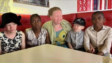Kamerun’da albinoslar afsun ve esassız inançlar yüzünden yıldırma altında