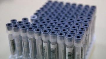 KKTC'ye girişlerde 1 Mart bakımından mükemmel aşılılardan Kovid-19 testi istenmeyecek