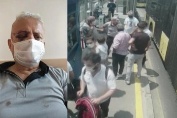 Maske uyarısında bulunduğu şahıs tarafından darp edilen güvenlik görevlisi görme yetisini kaybetti