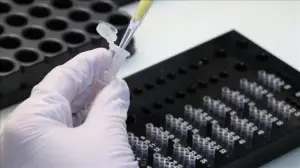 Mikrobiyoloji uzmanlarının yoğun 'PCR testi' mesaisi