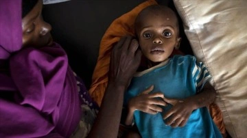 Somali'de kuraklık dolayısıyla 3 isim öldü