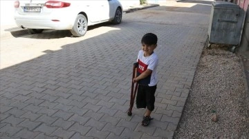 Suriyeli Muhammed protez bacakla yaşama tutunacak