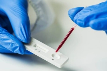 Türk bilim adamları 48 farklı antikor test kitini değerlendirdi